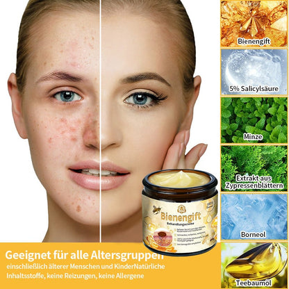 Turonu™ 𝑩𝒊𝒆𝒏𝒆𝒏𝒈𝒊𝒇𝒕-𝑩𝒆𝒉𝒂𝒏𝒅𝒍𝒖𝒏𝒈𝒔𝒄𝒓𝒆𝒎𝒆(𝐃𝐃𝐆-𝐄𝐦𝐩𝐟𝐞𝐡𝐥𝐮𝐧𝐠)💖